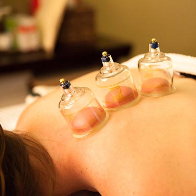 Cupping